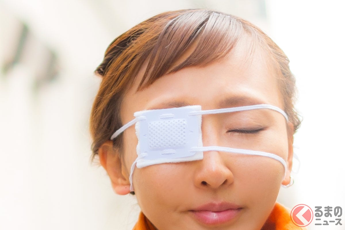 眼帯をして運転するのは問題あるのでしょうか?(画像Photo AC)